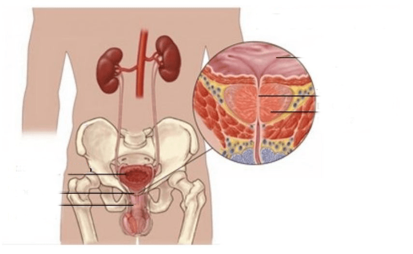 prostatite nos homes