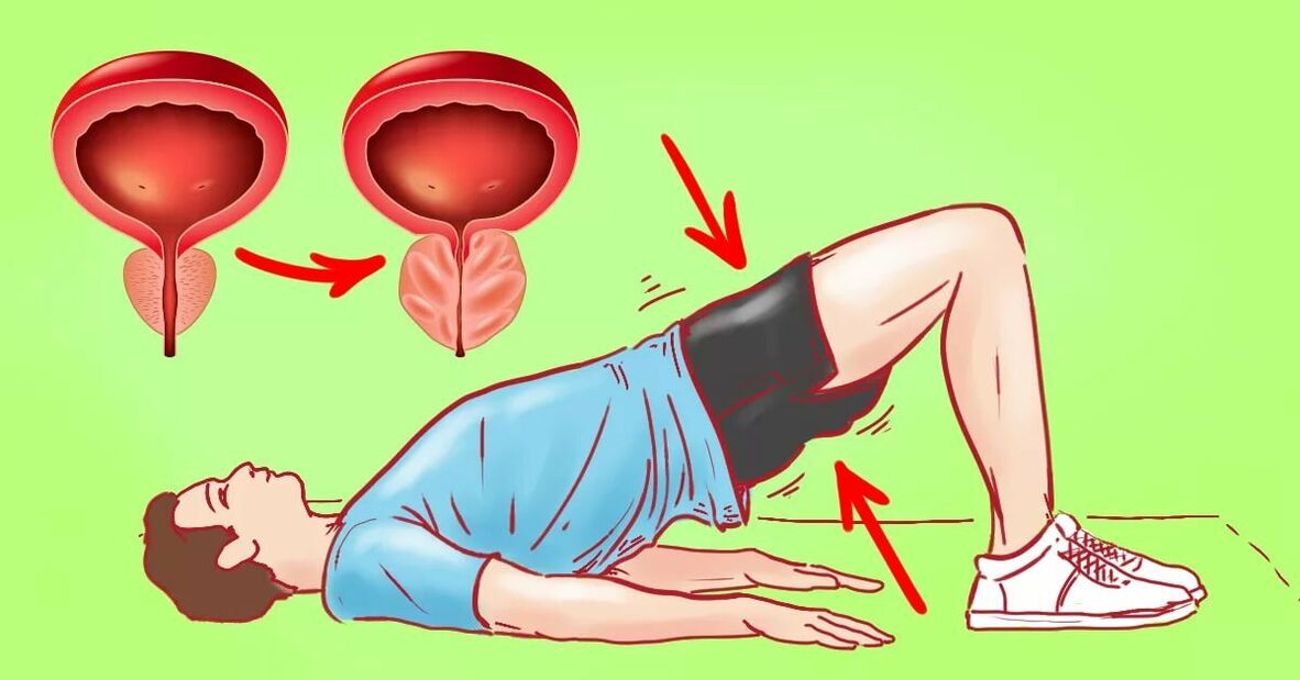 Exercicios para a prostatite